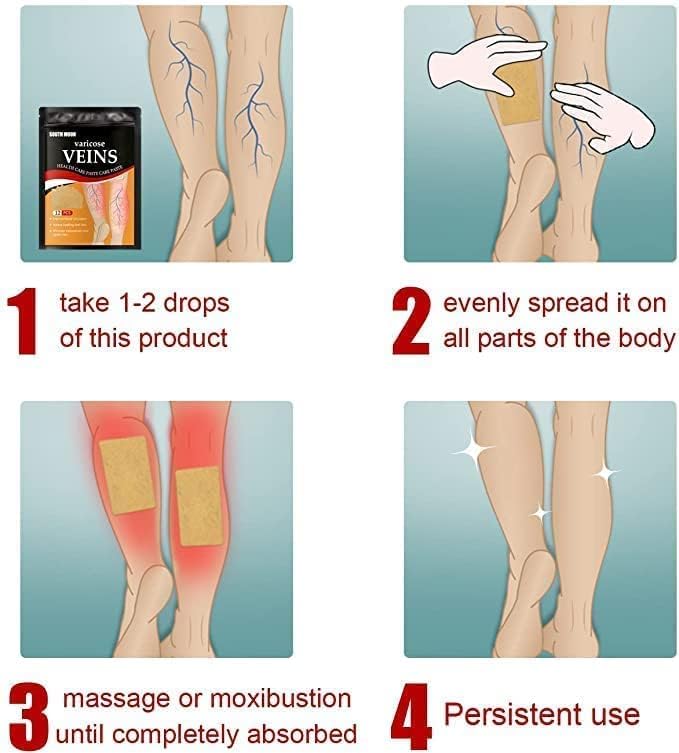 Varicose veins tape